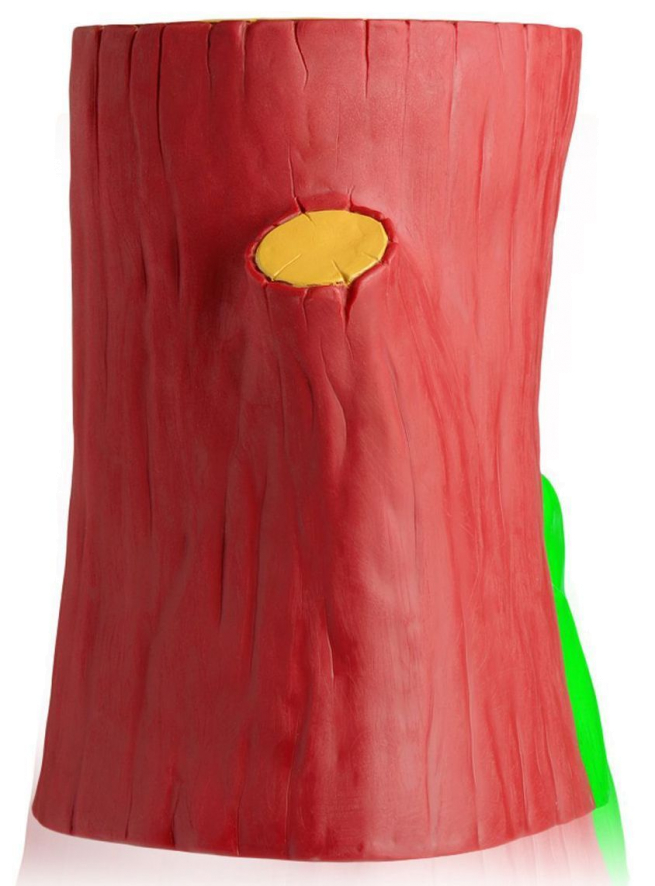 Gallery image for position 1